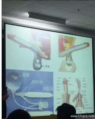 人造丁丁自动勃起？同志史上的今日事件-51虹马