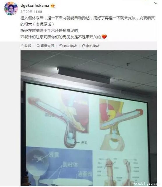 假体隆鸟术算什么?丁丁美白术已风靡泰国-51虹马