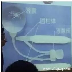 假体隆鸟术算什么？丁丁美白术已风靡泰国 - 51虹马