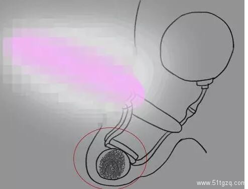 假体隆鸟术算什么？丁丁美白术已风靡泰国 - 51虹马