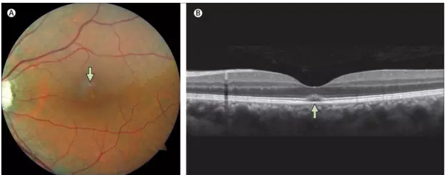 用Rush的基友，你是否开始觉得眼神不大好了？ - 51虹马