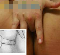 男性生殖器按摩教程圖-真人版 - 51虹马