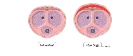 给自己丁丁注射干细胞求增大？这小哥，感觉已经魔怔了.. - 51虹马