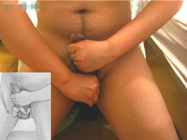 男性生殖器按摩教程圖-真人版 - 51虹马