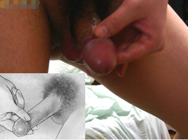 男性生殖器按摩教程圖-真人版 - 51虹马