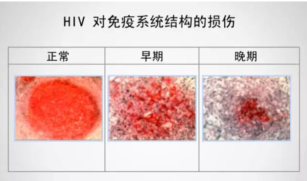 一次面基醉酒无套,HIV抗体从阴到阳! - 51虹马 一次面基醉酒无套,HIV抗体从阴到阳! - 51虹马