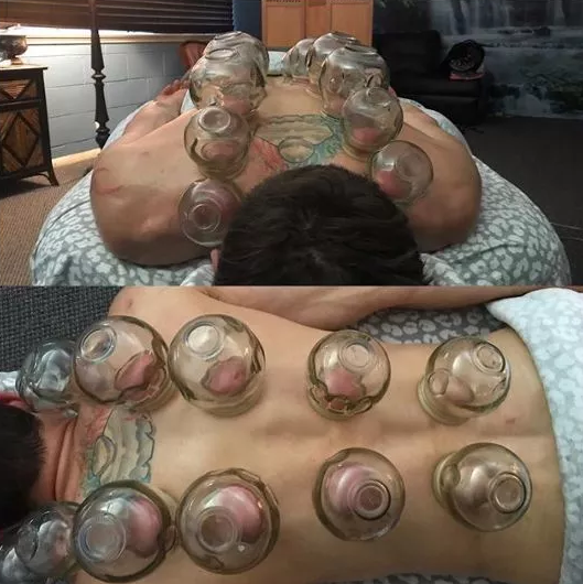 给自己丁丁注射干细胞求增大？这小哥，感觉已经魔怔了.. - 51虹马