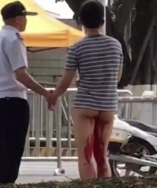 帅哥闹分手后切了自己的小兄弟 绕场跑圈！-51虹马