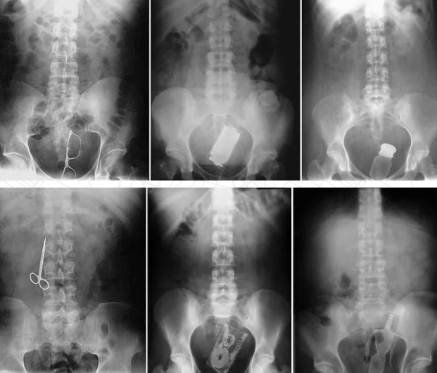每生产一个肛塞，就有一个无辜的猫猫被切掉尾巴 - 51虹马