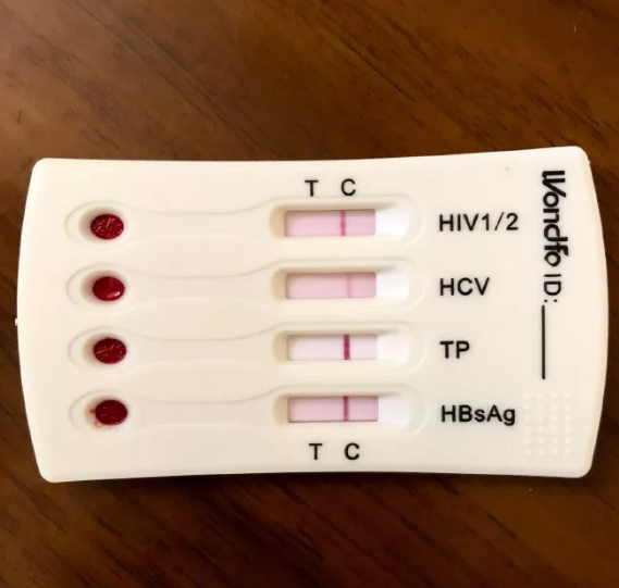 G圈红人小呆感染HIV吃药一年竟测不出感染了？ - 51虹马