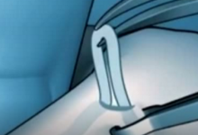 男性结扎手术视频，看完胯下一凉！-51虹马