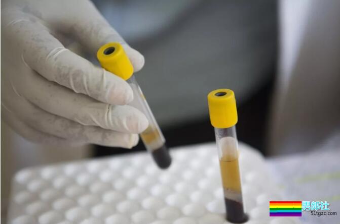 渣男炫耀感染艾滋病给大学生！专家：或涉刑事犯罪 - 51虹马