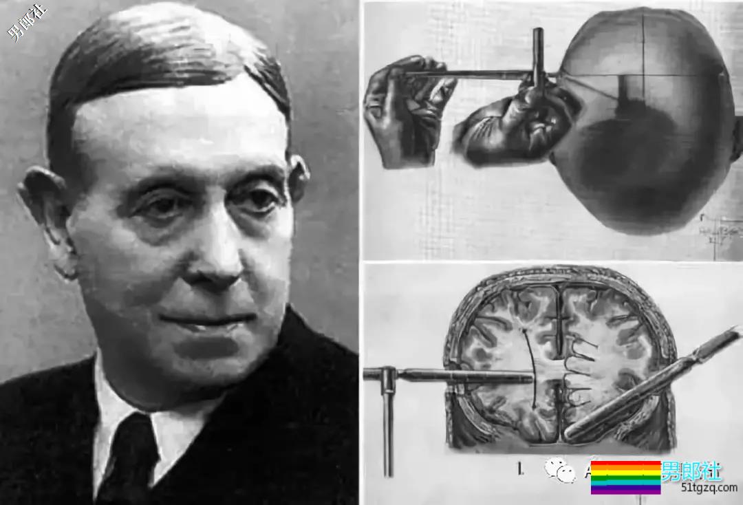 捆绑电击、囚禁强奸、化学阉割、睾丸移植,就为了“治好”同性恋? - 51虹马 捆绑电击、囚禁强奸、化学阉割、睾丸移植,就为了“治好”同性恋? - 51虹马