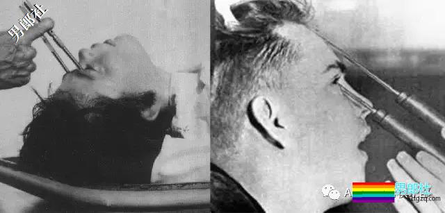 捆绑电击、囚禁强奸、化学阉割、睾丸移植,就为了“治好”同性恋? - 51虹马 捆绑电击、囚禁强奸、化学阉割、睾丸移植,就为了“治好”同性恋? - 51虹马