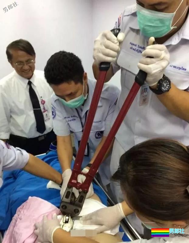 山东大学生弟弟套铁环肿胀巨大！求助消防员才取下 - 51虹马