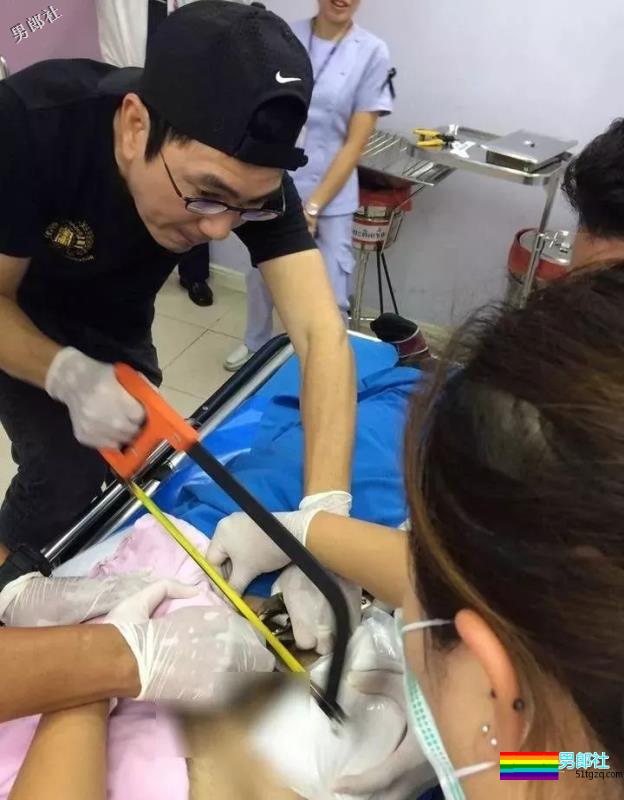 山东大学生弟弟套铁环肿胀巨大！求助消防员才取下 - 51虹马