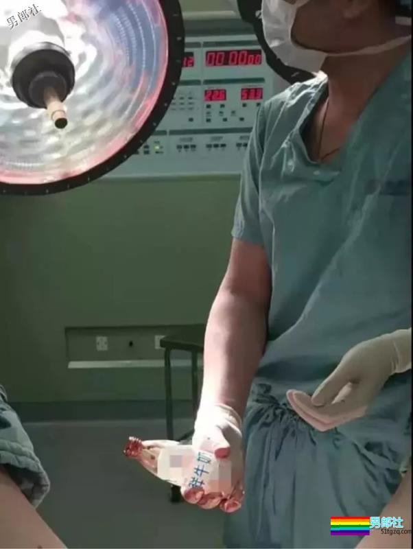 男子PP里塞牛奶瓶,取不出来了! - 51虹马 男子PP里塞牛奶瓶,取不出来了! - 51虹马