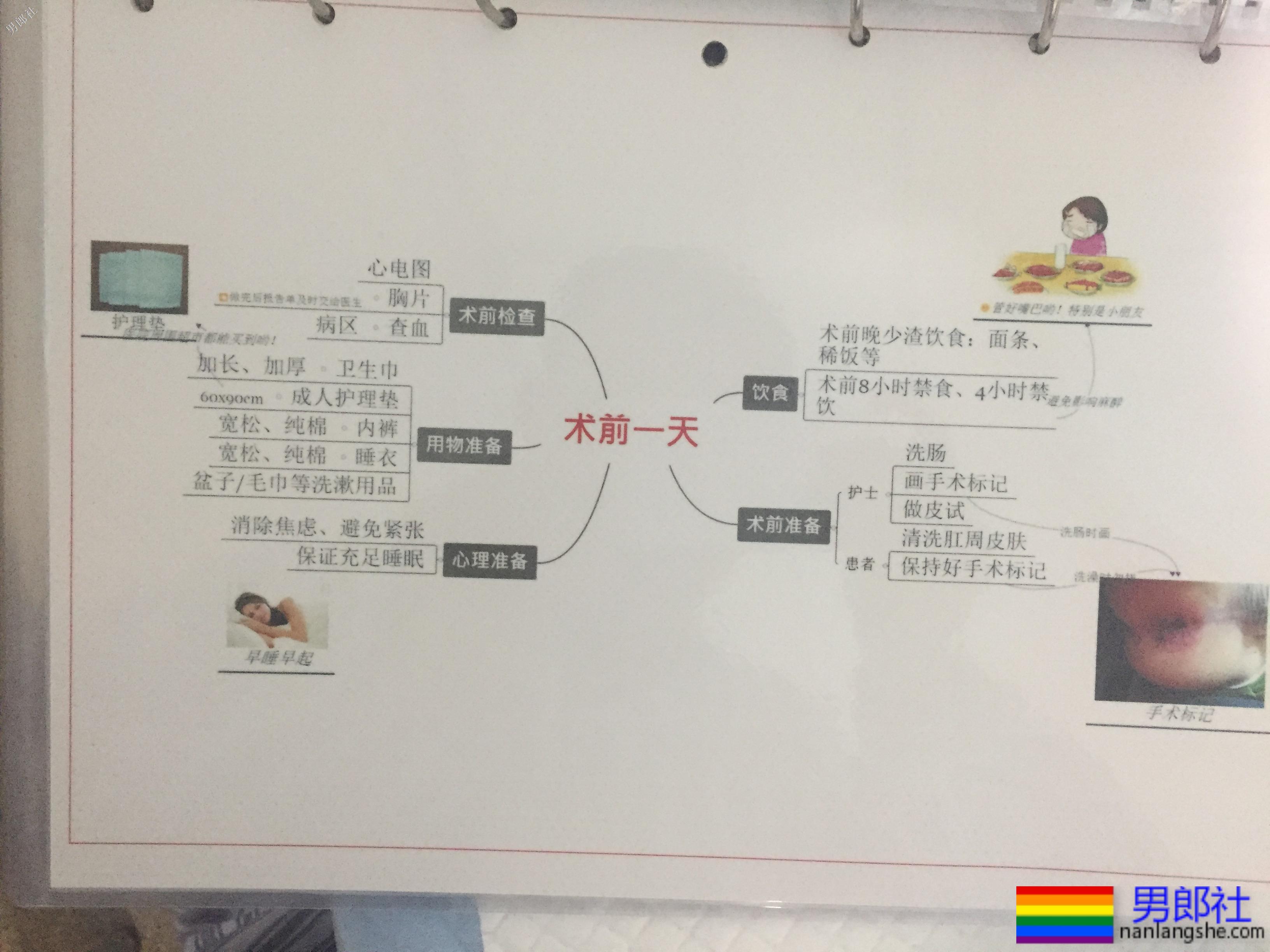 我的痔疮手术过程，不痛没有任何心理压力 - 51虹马