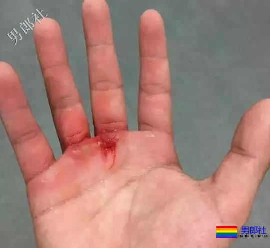 这些肌肉男因为撸的次数太频繁，一双手都变样了！ - 51虹马