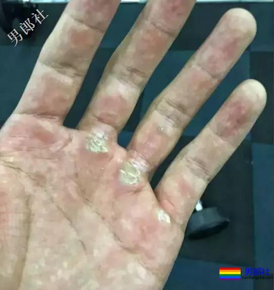 这些肌肉男因为撸的次数太频繁，一双手都变样了！ - 51虹马