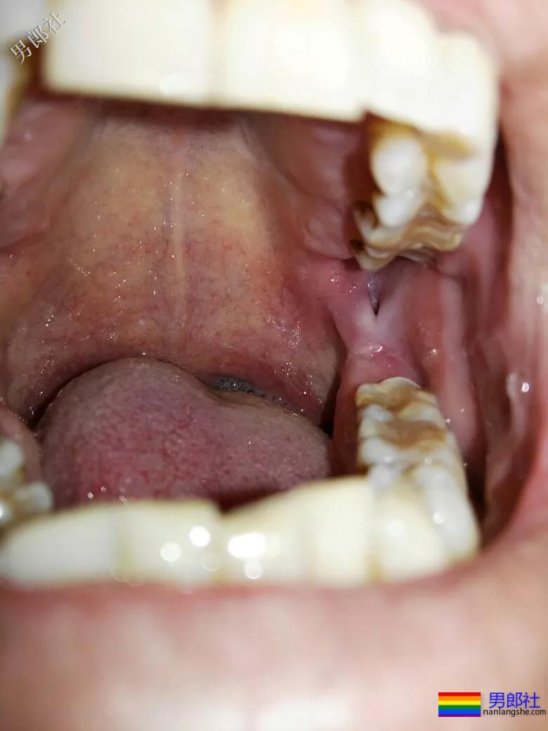 48岁农民工痛丧命根:你见过的男厕鸟洞,99%有毒! - 51虹马 48岁农民工痛丧命根:你见过的男厕鸟洞,99%有毒! - 51虹马