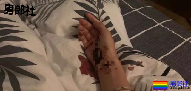 小鲜肉睡跨性别者染病，还传染给女朋友 - 51虹马