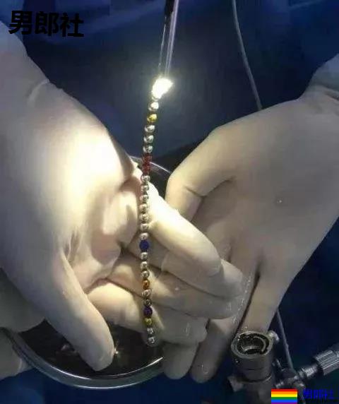 西安一男子往尿道塞了28颗巴克球…现在的同志真会玩! - 51虹马 西安一男子往尿道塞了28颗巴克球…现在的同志真会玩! - 51虹马