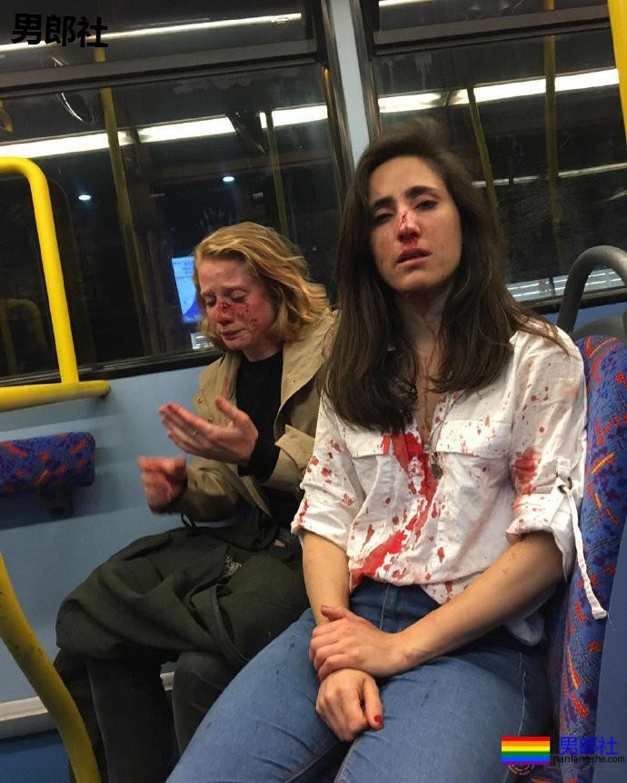 伦敦巴士同性情侣遇袭案：三名嫌犯认罪 - 51虹马