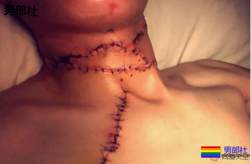 17岁少年被父亲割喉就因你是同性恋?-51虹马