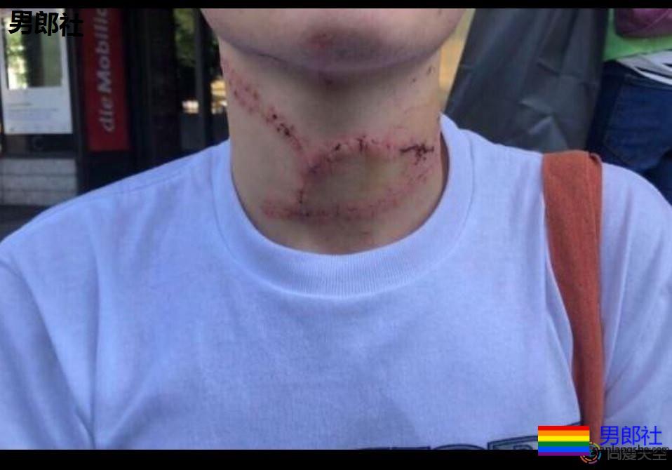 17岁少年被父亲割喉就因你是同性恋? - 51虹马 17岁少年被父亲割喉就因你是同性恋? - 51虹马