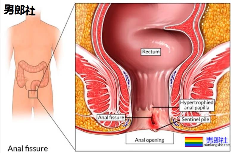 长期做0真的会漏S吗？ - 51虹马