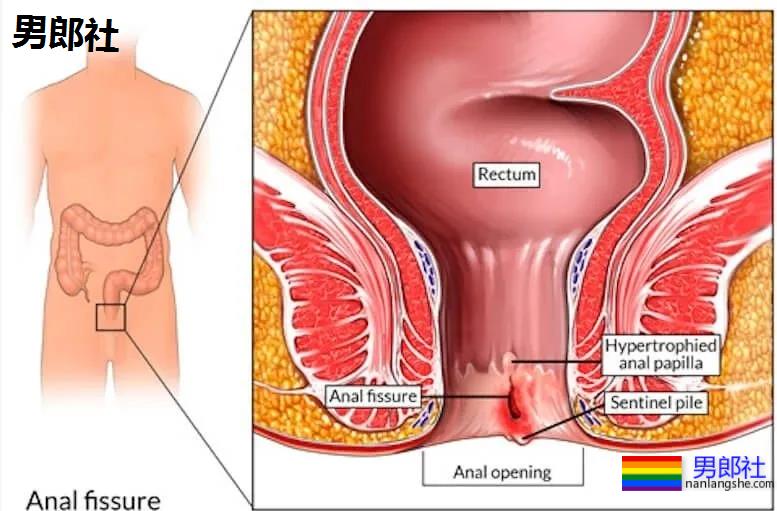 长期做0真的会漏S吗？ - 51虹马