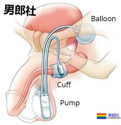 长期做0真的会漏S吗？ - 51虹马