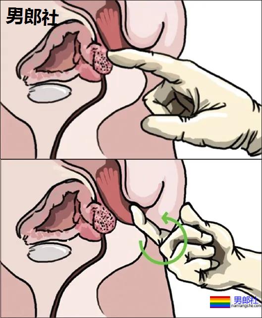 长期做0真的会漏S吗？ - 51虹马