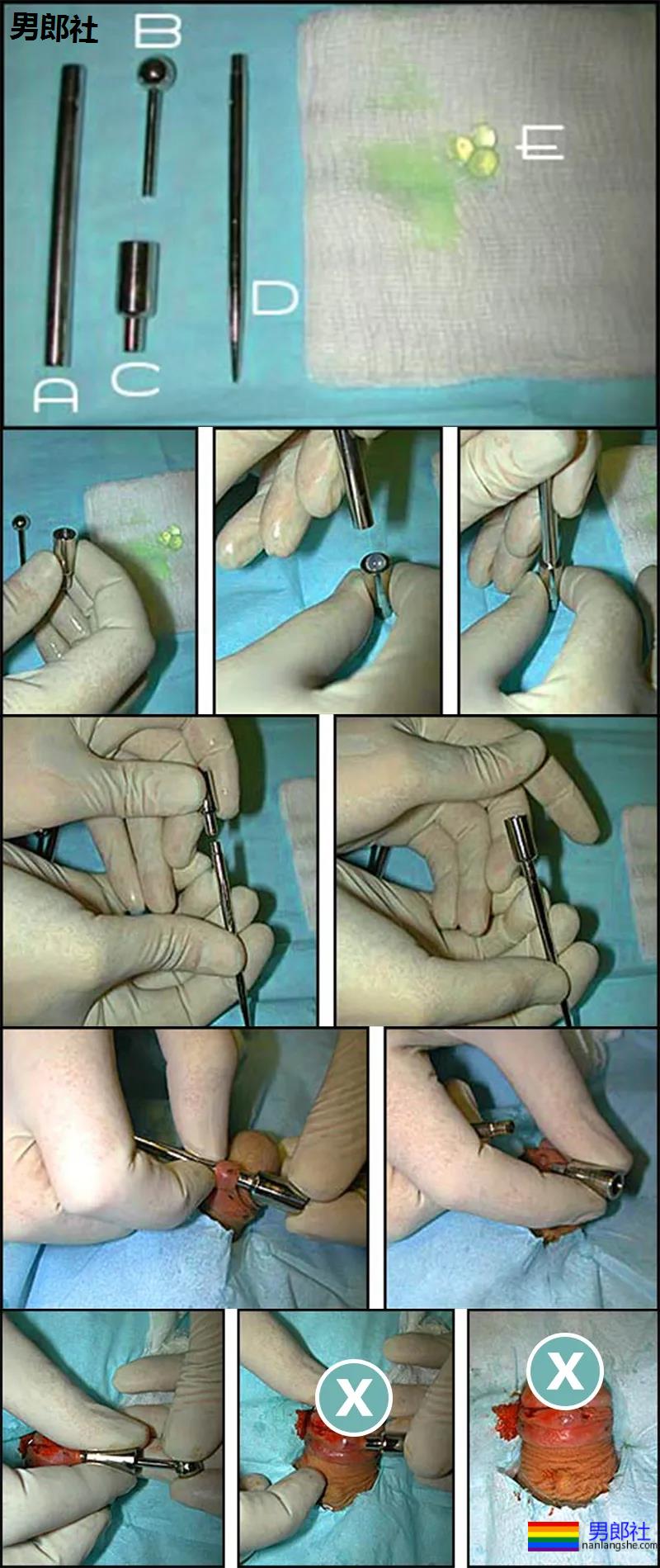 入珠1和穿孔0，小众性文化的审美风险 - 51虹马