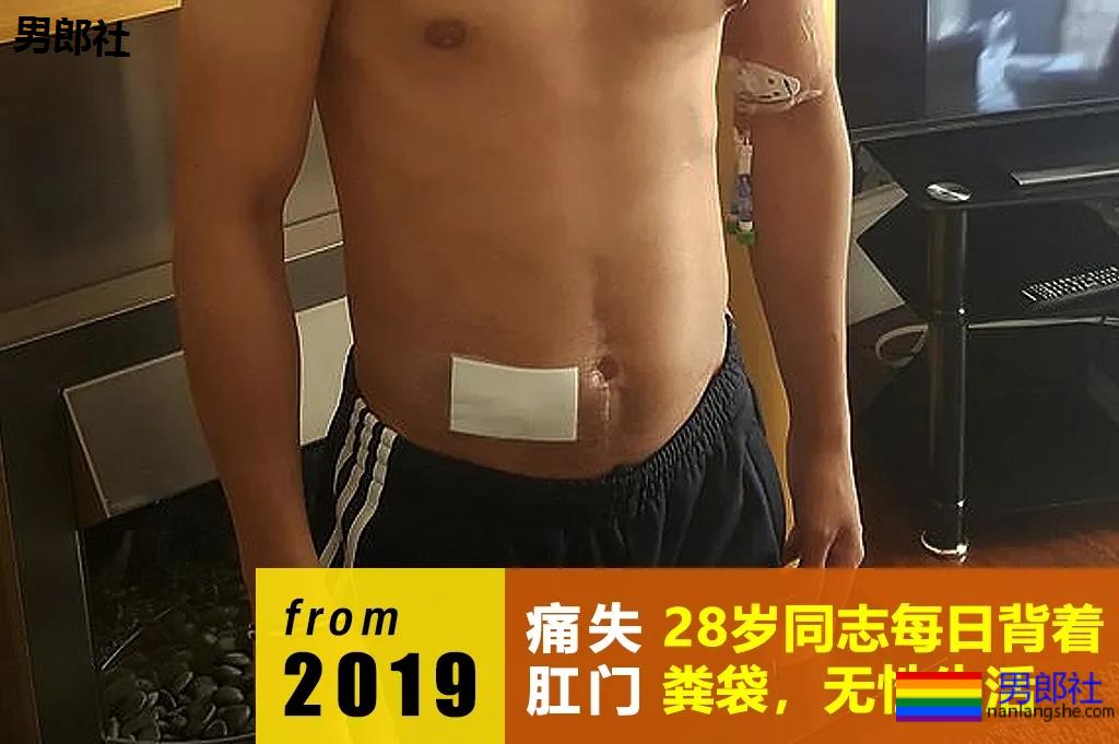 菊花长疣物，需不需要动手术？-51虹马