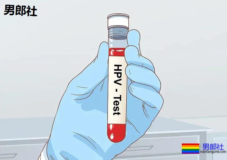 菊花长疣物，需不需要动手术？ - 51虹马