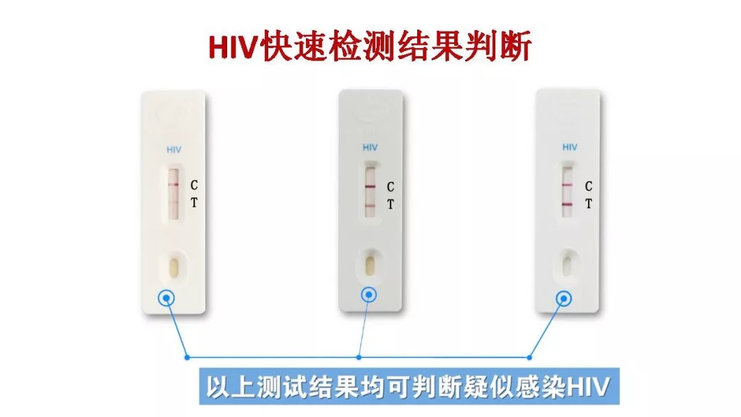 看完这12个HIV感染的案例，还敢无套啪啪啪吗？ - 51虹马