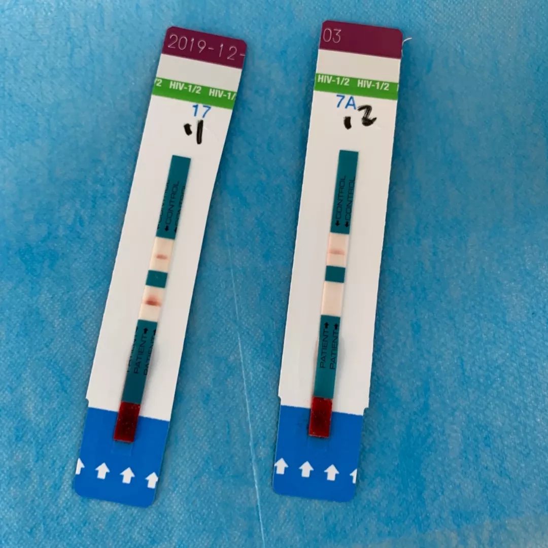 看完这12个HIV感染的案例，还敢无套啪啪啪吗？ - 51虹马