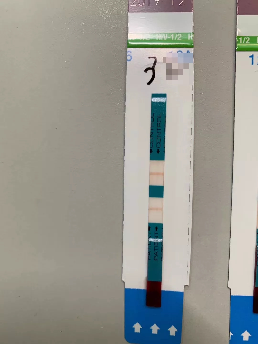 看完这12个HIV感染的案例，还敢无套啪啪啪吗？ - 51虹马