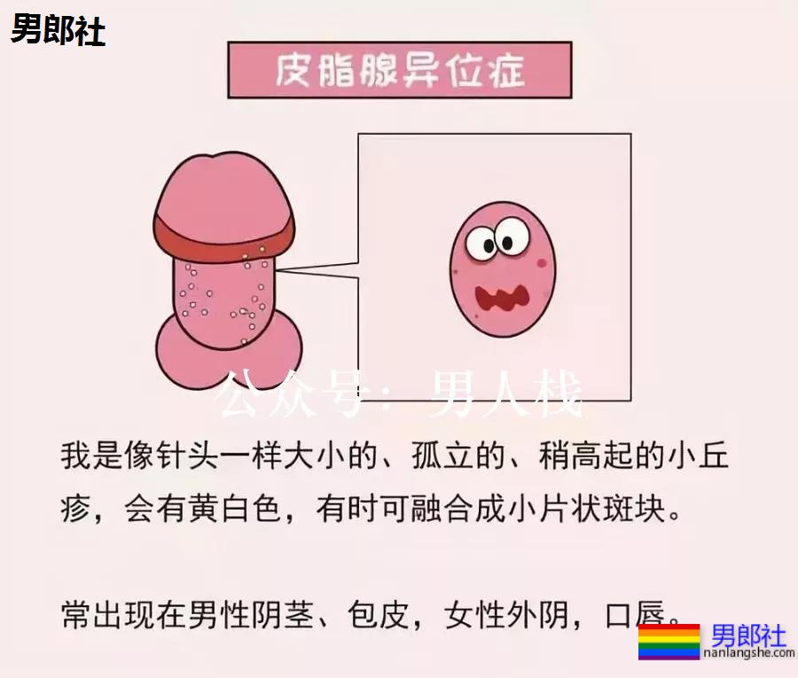 生殖器长小米粒疙瘩是病吗？ - 51虹马