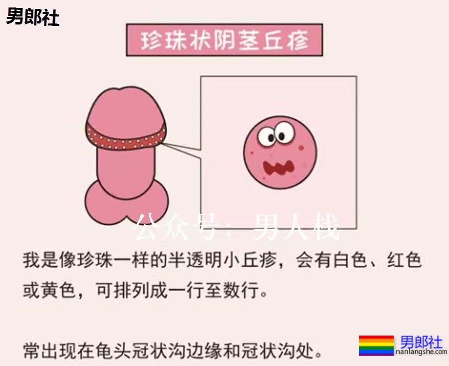 生殖器长小米粒疙瘩是病吗？ - 51虹马