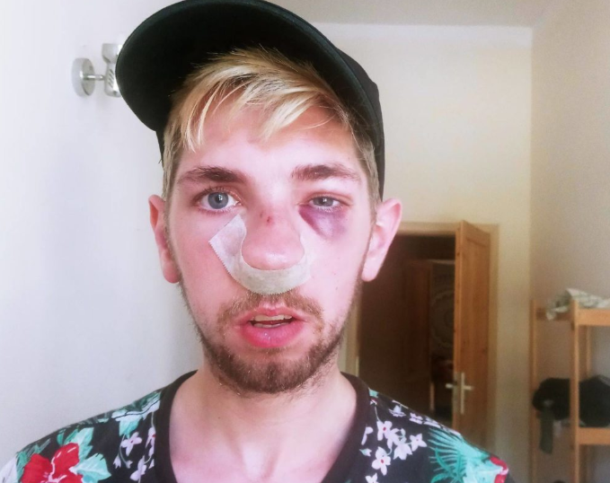 波兰男同志遭醉汉袭击 光天化日之下被暴打抢劫-51虹马