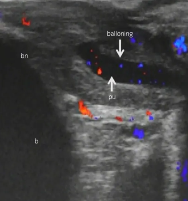 农牛是不是安全合理的性行为? - 51虹马 农牛是不是安全合理的性行为? - 51虹马