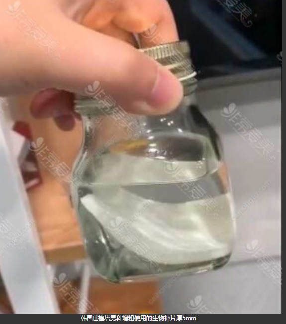 亲身经历阴茎增大手术, 粗重要还是长重要 - 51虹马 亲身经历阴茎增大手术, 粗重要还是长重要 - 51虹马