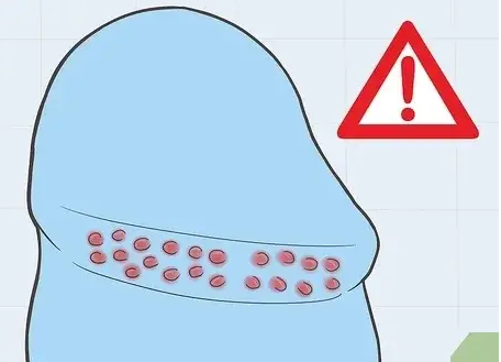 关于「龟头」的10个真相 - 51虹马 关于「龟头」的10个真相 - 51虹马
