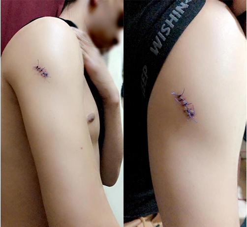 19岁摩洛哥青年在西班牙遭恐同暴力攻击 歹徒叫嚣:死娘炮 - 51虹马 19岁摩洛哥青年在西班牙遭恐同暴力攻击 歹徒叫嚣:死娘炮 - 51虹马