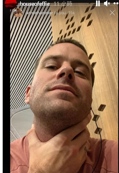 《以你的名字唿唤我》艾米汉默身陷「食人」性丑闻!宣布退出新片回应「超噁私讯」指控 - 51虹马 《以你的名字唿唤我》艾米汉默身陷「食人」性丑闻!宣布退出新片回应「超噁私讯」指控 - 51虹马