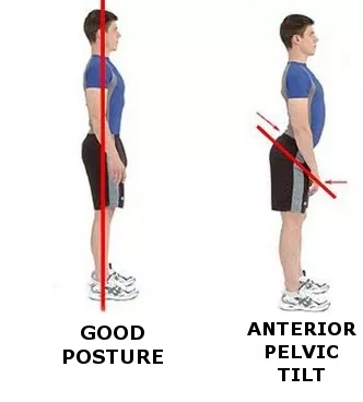 “假翘臀”欺骗了多少肌肉男? - 51虹马 “假翘臀”欺骗了多少肌肉男? - 51虹马