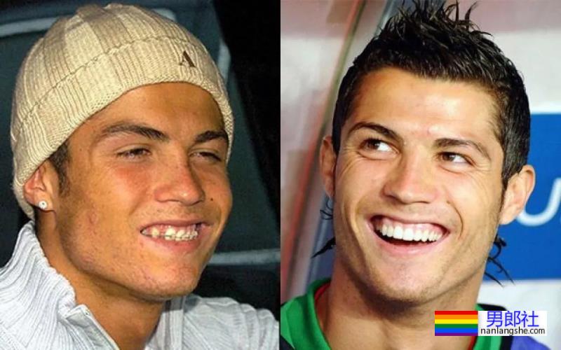 C罗竟然往那里注射肉毒？？这得多疼啊…… - 51虹马